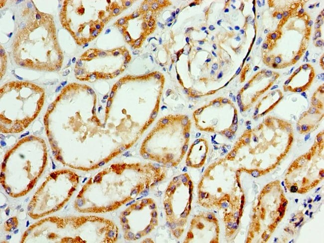 100UL AP1M2 ANTIBODY 100 ul