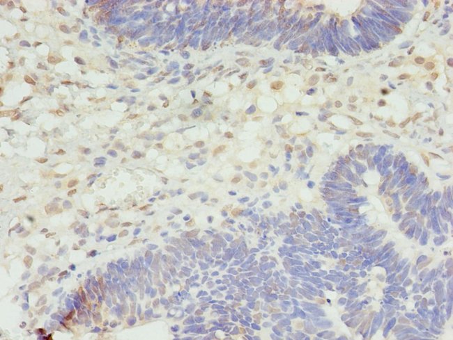 100UG STK38L ANTIBODY 100 ug
