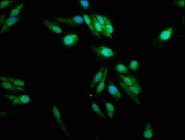 100UG PADI2 ANTIBODY 100 ug
