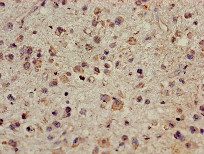 100UG CDYL ANTIBODY 100 ug