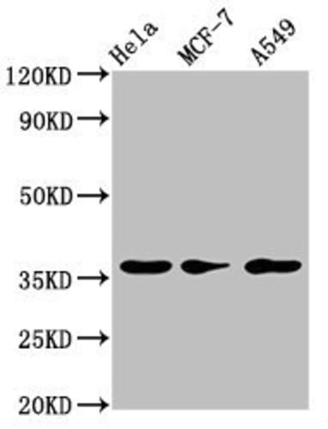 100UG RCE1 ANTIBODY 100 ug