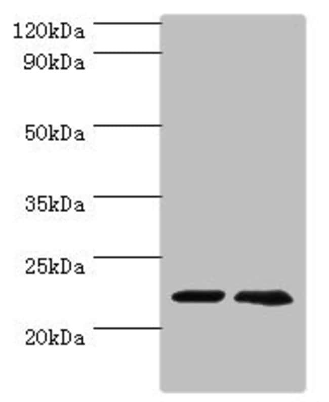 100UL ASF1A ANTIBODY 100 ul