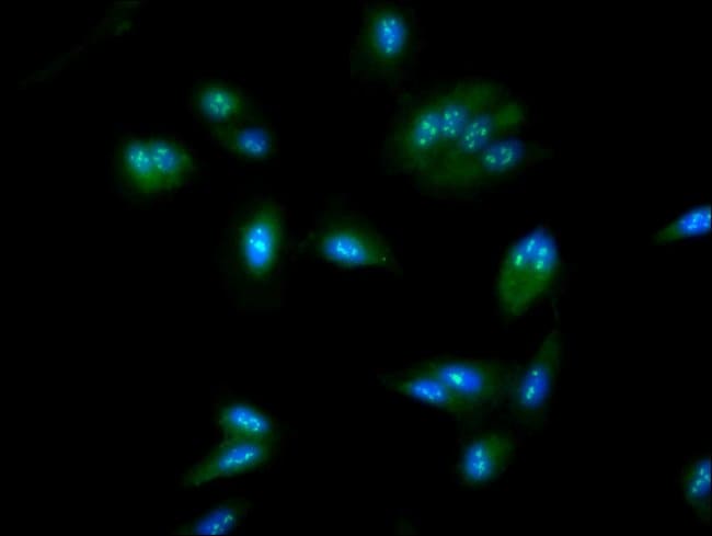 100UG NOP58 ANTIBODY 100 ug