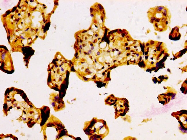 100UG NFE2L3 ANTIBODY 100 ug