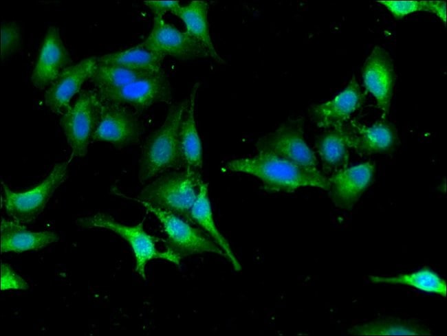 100UG SEC23IP ANTIBODY 100 ug