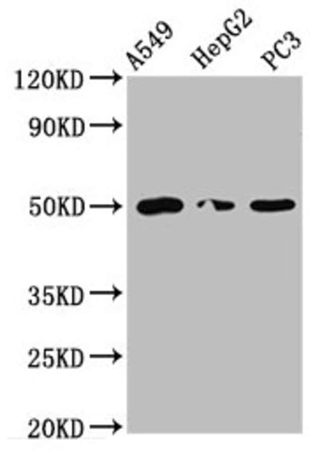 100UG IFT52 ANTIBODY 100 ug