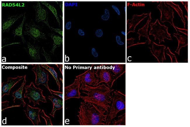 100UG RAD54L2 ANTIBODY 100 ug