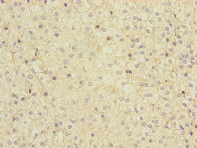 100UL MMACHC ANTIBODY 100 ul