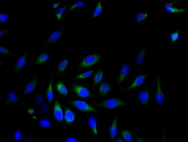 100UG SRPRB ANTIBODY 100 ug