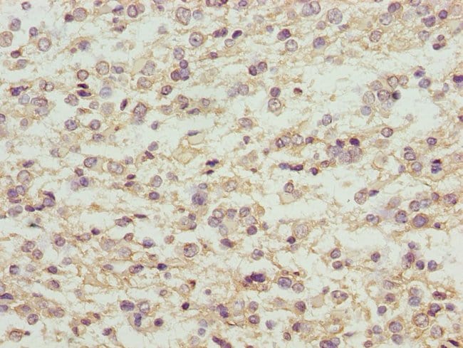 100UL MAGED1 ANTIBODY 100 ul