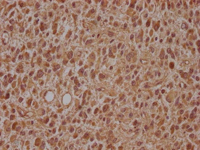 100UL ARL2BP ANTIBODY 100 ul