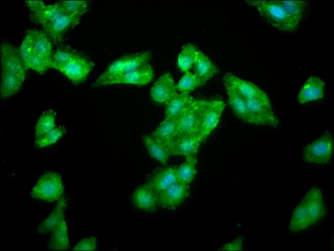 100UG LAS1L ANTIBODY 100 ug
