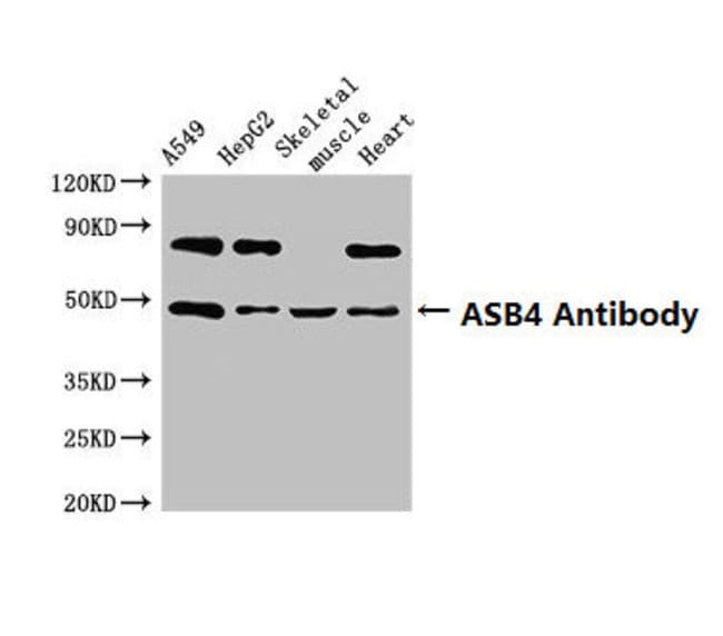 100UG ASB4 ANTIBODY 100 ug