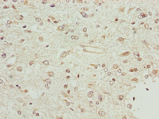 100UL BCS1L ANTIBODY 100 ul