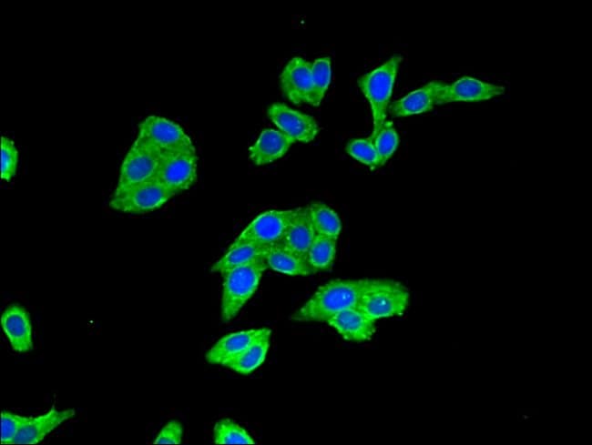 100UG BTRC ANTIBODY 100 ug