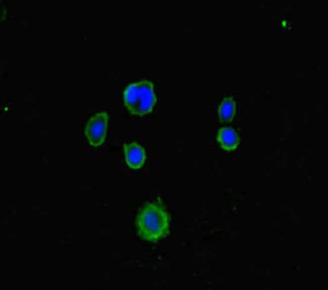 100UG LRCH1 ANTIBODY 100 ug
