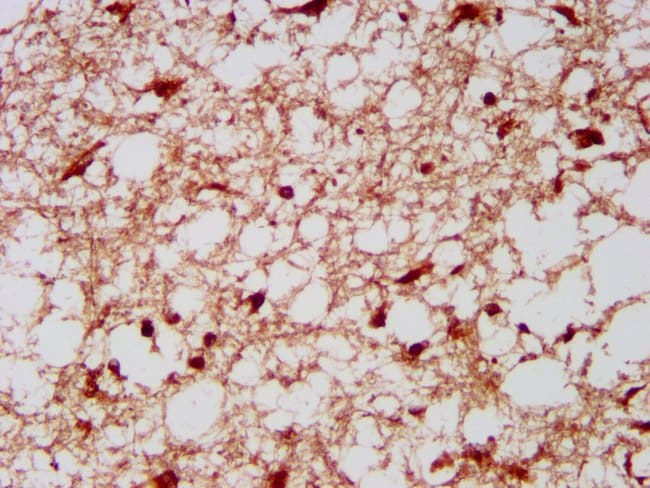 100UG RFLAT-1 ANTIBODY 100 ug