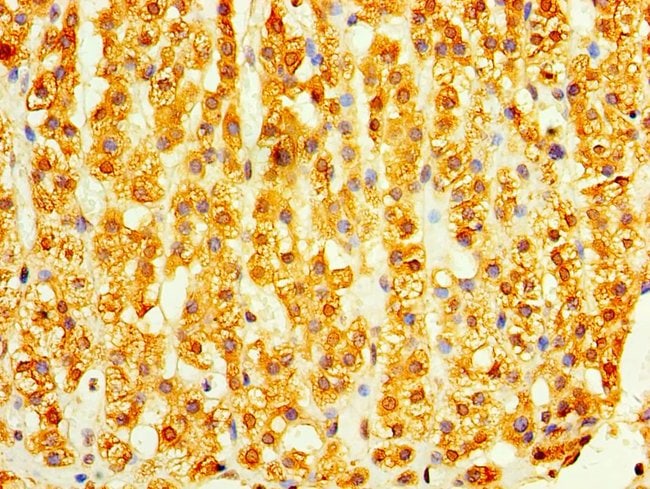 100UG DHRS7 ANTIBODY 100 ug