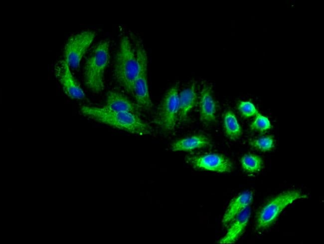 100UG FARP1 ANTIBODY 100 ug