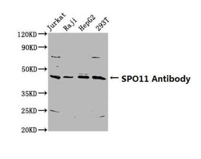 100UG SPO11 ANTIBODY 100 ug