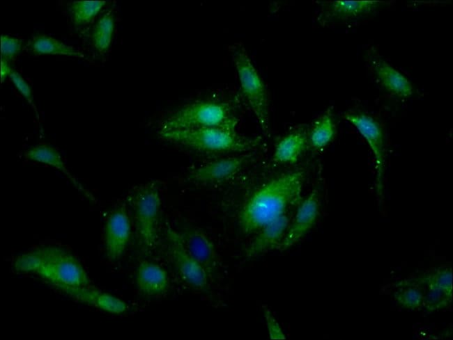 100UG SSX2IP ANTIBODY 100 ug