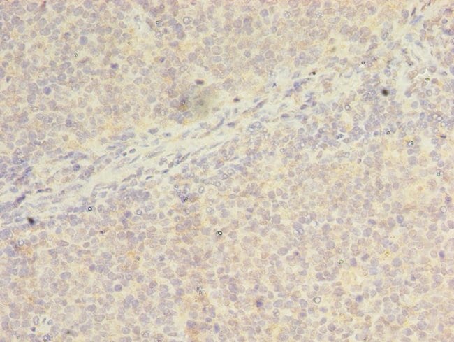 100UG WDR37 ANTIBODY 100 ug