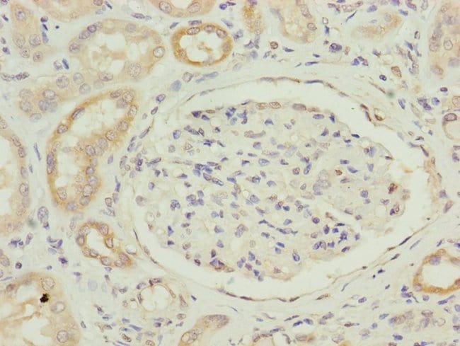 100UL FAM96B ANTIBODY 100 ul