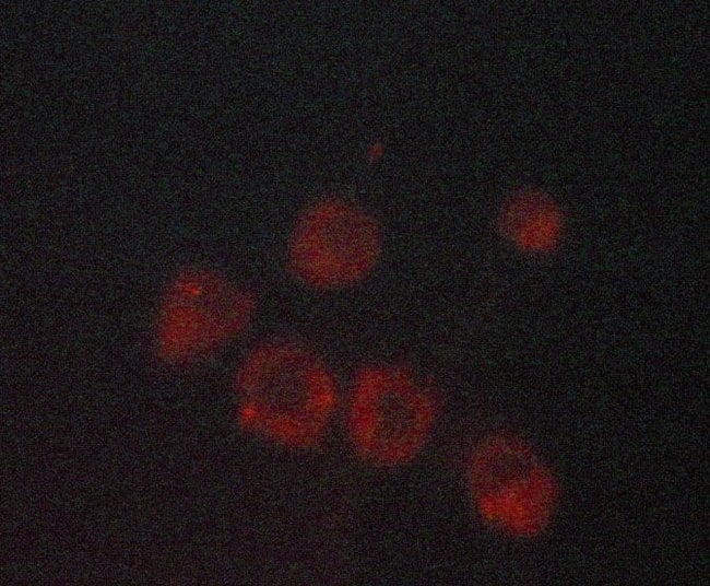 100 UL CDKN2B Polyclonal Antibody, 100µL