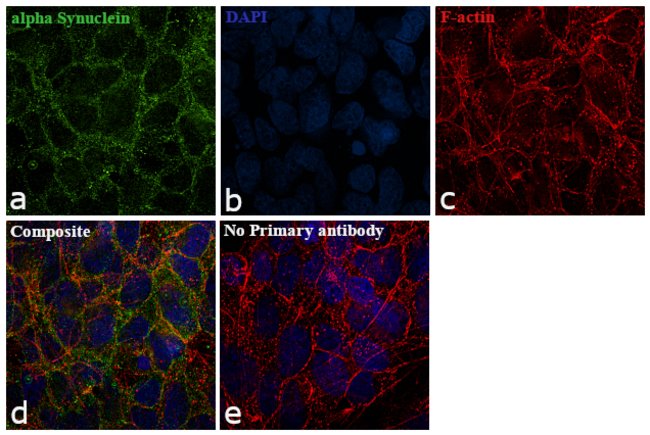 ALPHA-SYNUCLEIN, 100 µL