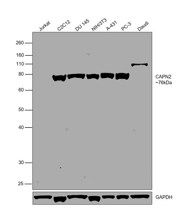 100UL CALPAIN 2 LARGE SUBUNIT (M-TYPE) .