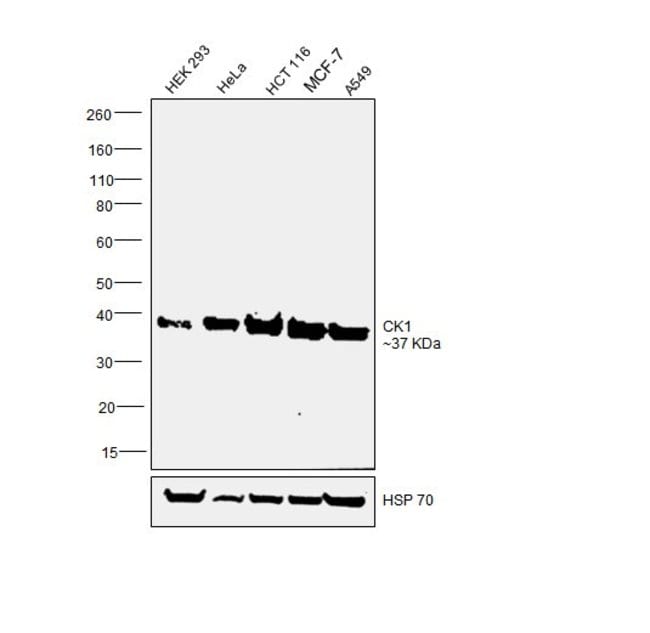 100UL ANTI-CK1 POLYCLONAL ANTIBODY .