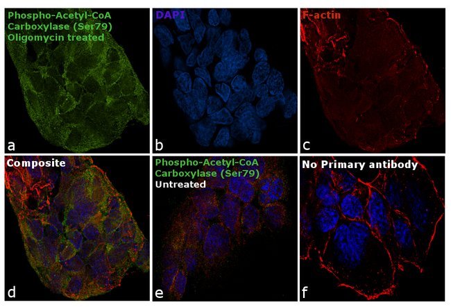 Antibody Phospho-Acetyl-CoA Carboxylase