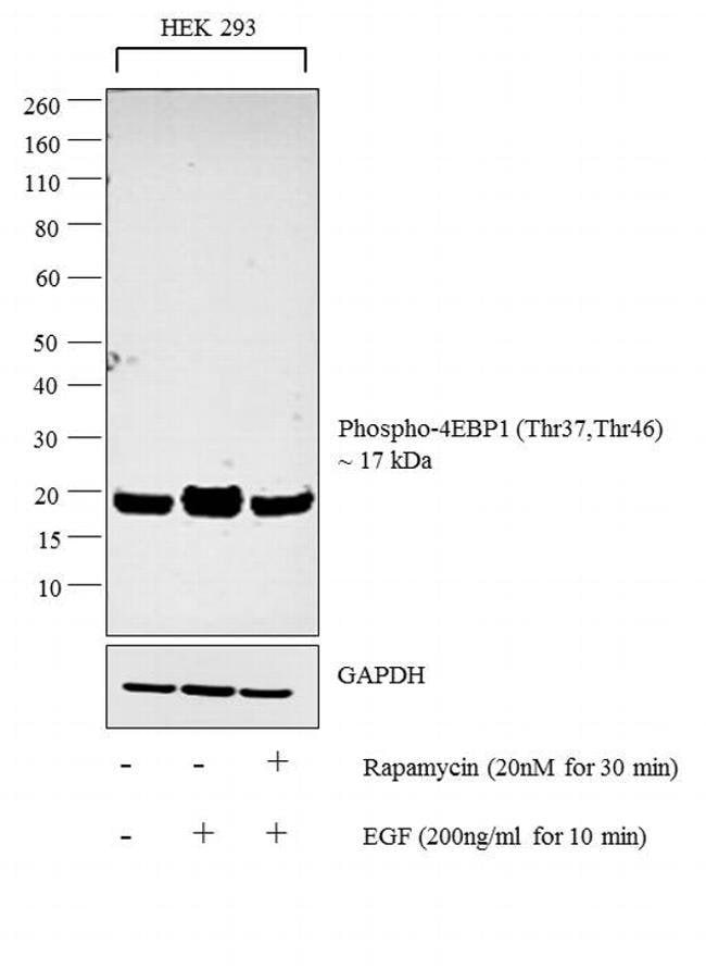 100UL PHOSPHO-4E-BP1 (THR37/46) .