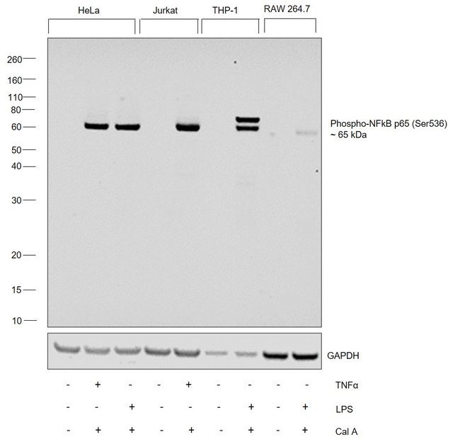 100UL PHOSPHO-NF-KAPPAB P65 (SER536) .