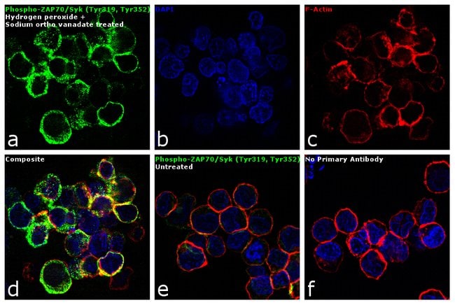 Antibody Phospho-Zap-70 (Tyr319)/Syk (Ty