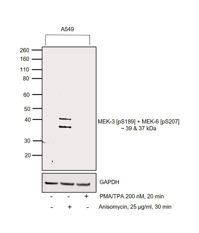 Antibody Phospho-NhpK3 (Ser189)/NhpK6 (S