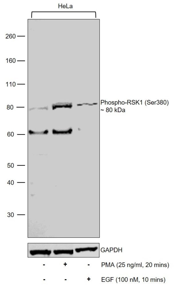 100UL PHOSPHO-P90RSK (SER380) .
