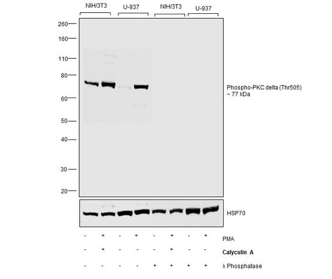 100UL PHOSPHO-PKCDELTA (THR505) .