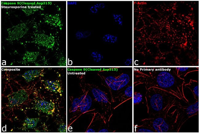 100UL CLEAVED CASPASE-9 (ASP315) .