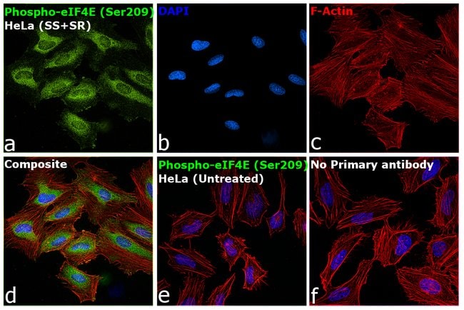 100UL PHOSPHO-EIF4E (SER209) .