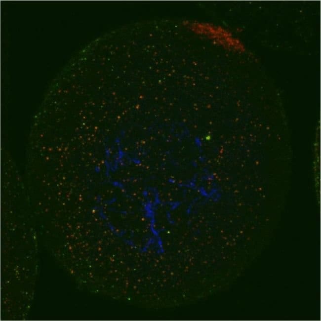 4E-T/EIF4ENIF1 Polyclonal Antibody 100 µ