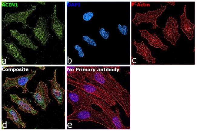 Acinus Polyclonal Antibody, 100 µg