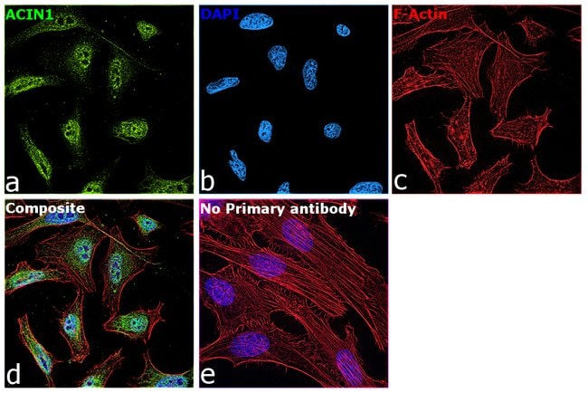 Acinus Polyclonal Antibody, 100 µg