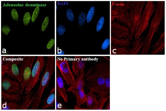 Adenosine Deaminase Polyclonal Antibody,