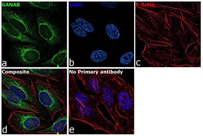 alpha Glucosidase II Polyclonal antibody