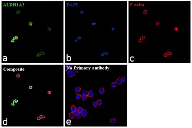 ALDH1A2 Polyclonal Antibody, 100 µl