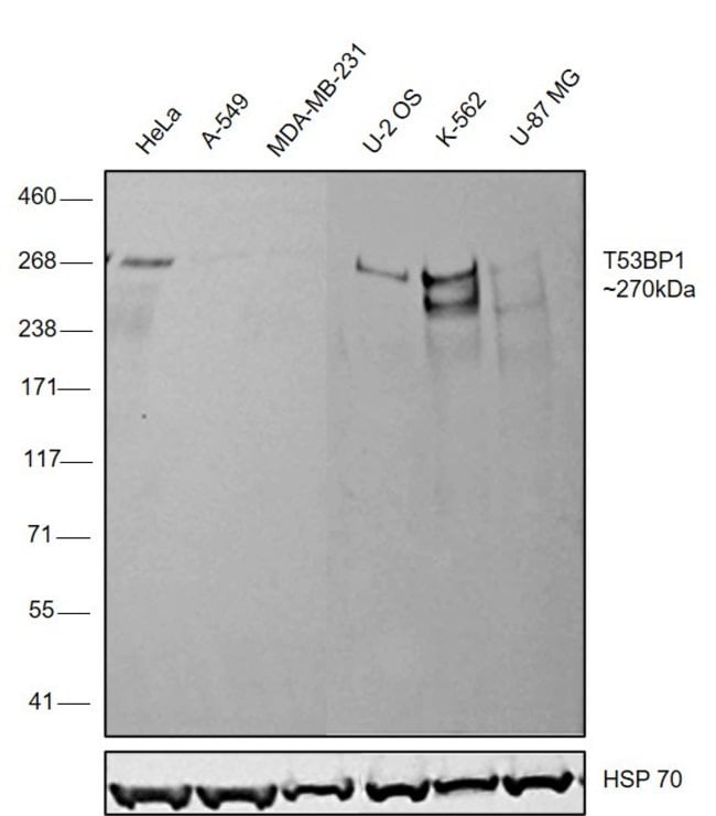 53BP1 Polyclonal Antibody, DyLight 488 c