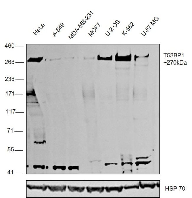 53BP1 Polyclonal Antibody, DyLight 488 c