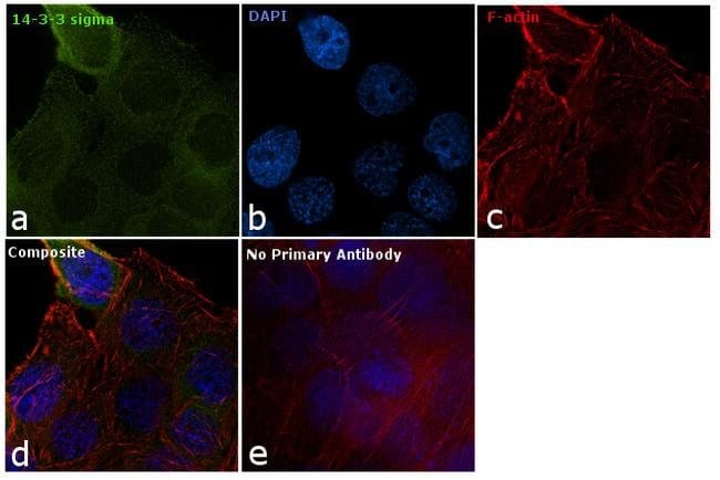 14-3-3 sigma Polyclonal Antibody, 100 µg