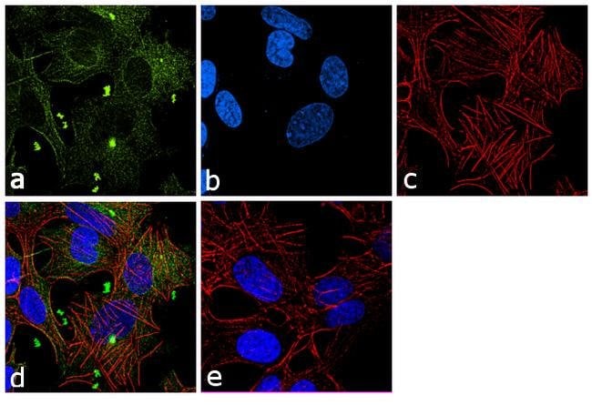 Anti-beta Tubulin 2